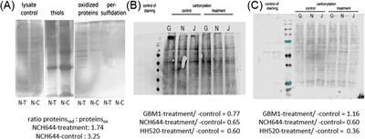 Muscarinic receptor drug trihexyphenidyl can alter growth of mesenchymal glioblastoma in vivo